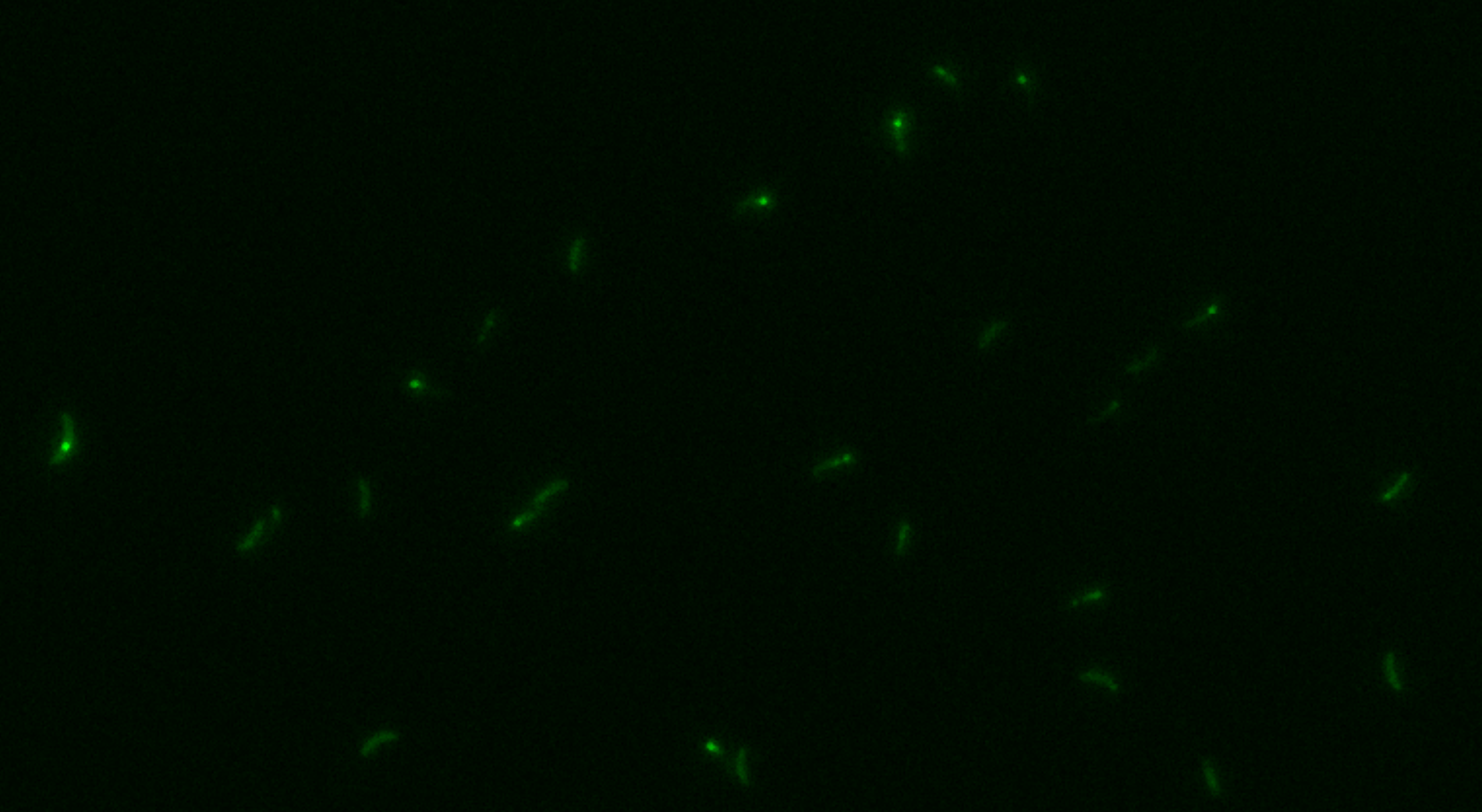 Example of the bacteria in the GFP channel